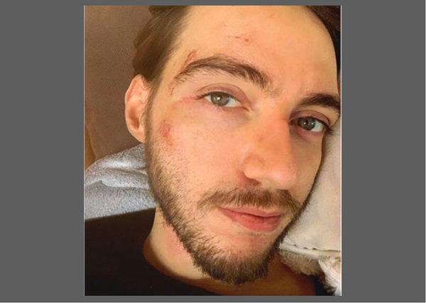 Gay Belgian Man Attacked, Fears Reporting Crime to Police