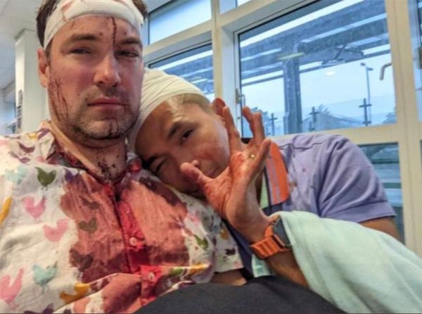 Gay Couple Gashed with Glass Bottles in 'Appalling Hate Crime' in England