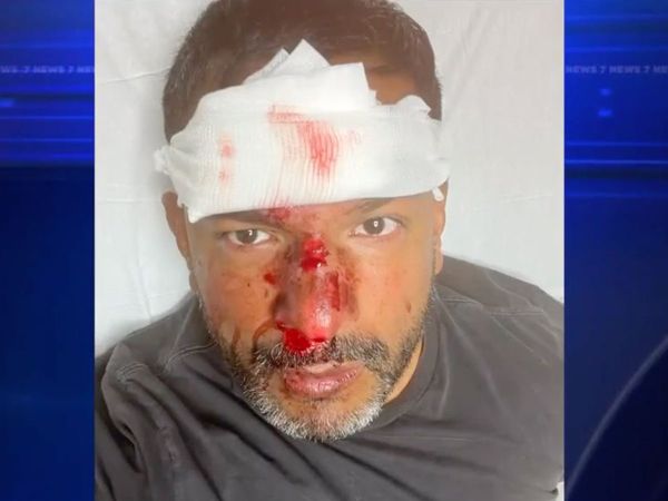 South Florida Man Wants Hate Crime Charges after Alleged Homophobic Assault